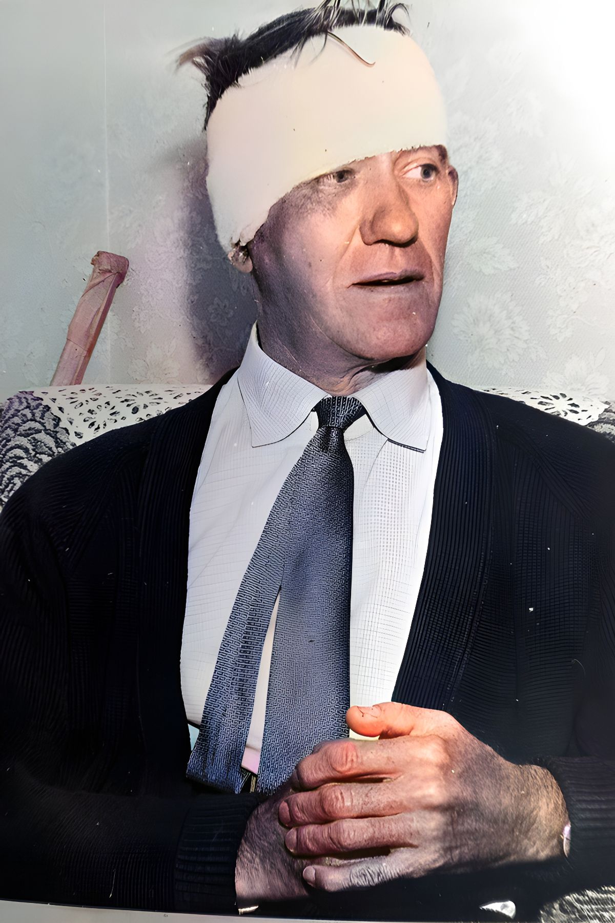 Train driver Jack Mills with a bandage wrapped round his head